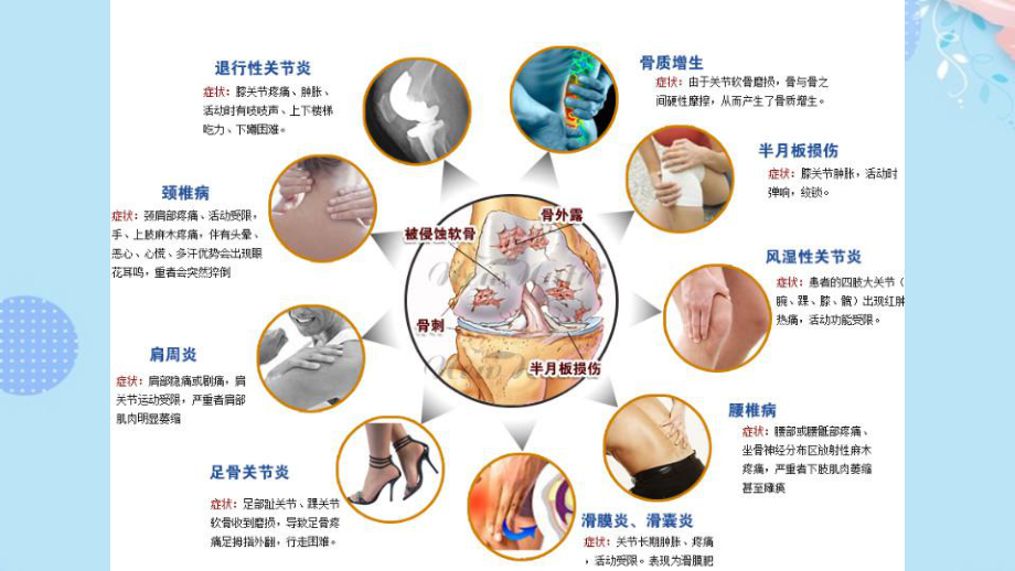 骨关节健康氨糖氨糖疗法完整版PPT课件.pptx_第3页