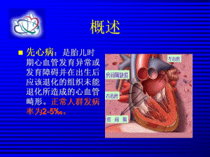 先心病介入治疗课件.ppt