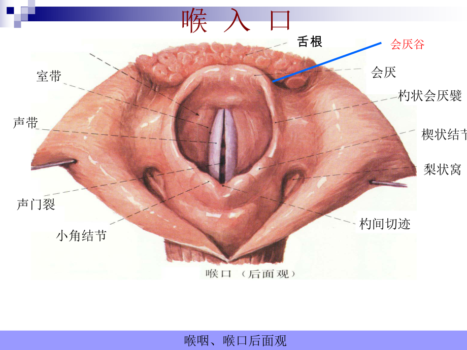 喉癌护理查房课件 (2).ppt_第3页