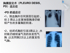 常用胸膜粘连药物课件 (2).ppt