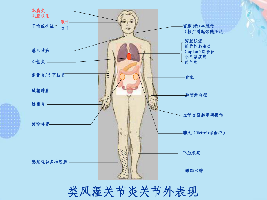 风湿科常用免疫抑制剂完整版PPT课件.ppt_第2页