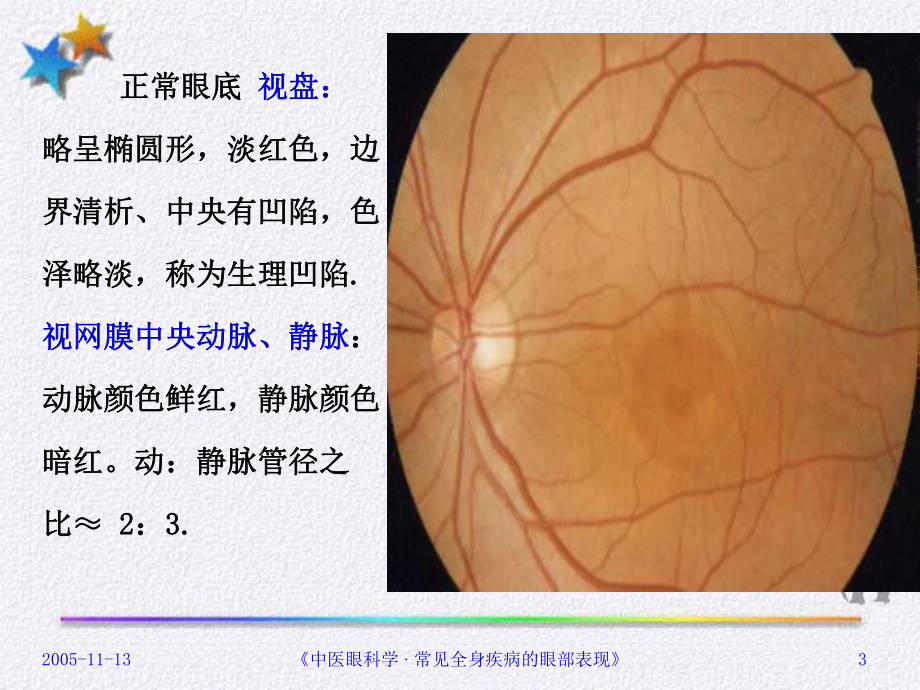 全身疾病的眼部表现(课堂PPT)课件.ppt_第3页