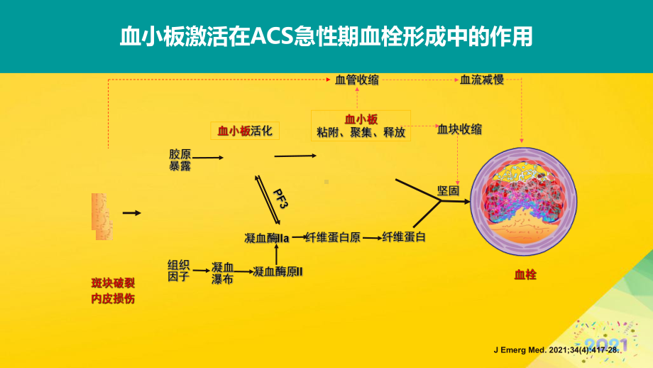 双联抗血小板治疗临床时程探讨标准版资料课件.ppt_第2页