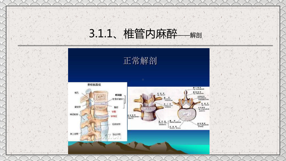 医疗教学之椎管内麻醉教育PPT动态资料课件.pptx_第3页