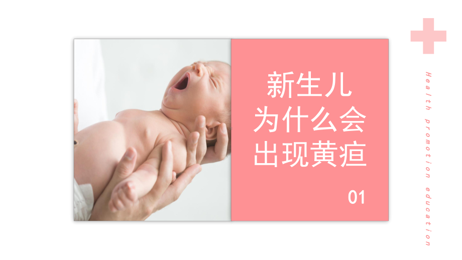 新生儿黄疸健康教育宣传通用教育PPT动态资料课件.pptx_第3页