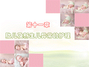 妇产科护理第十一章胎儿及新生儿异常-图文课件.ppt