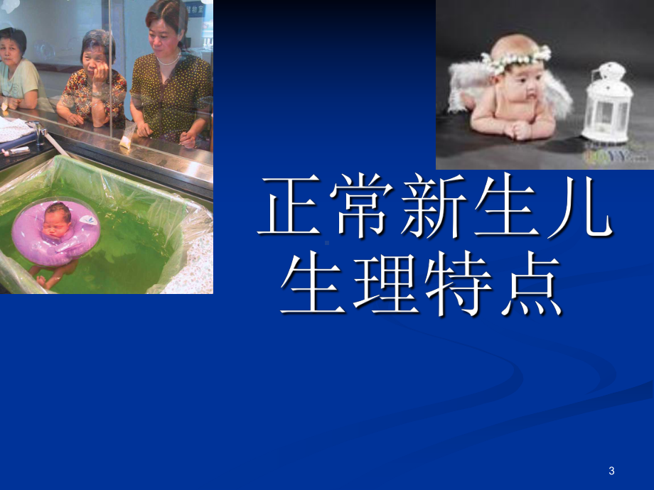 新生儿常见的生理现象PPT课件.ppt_第3页