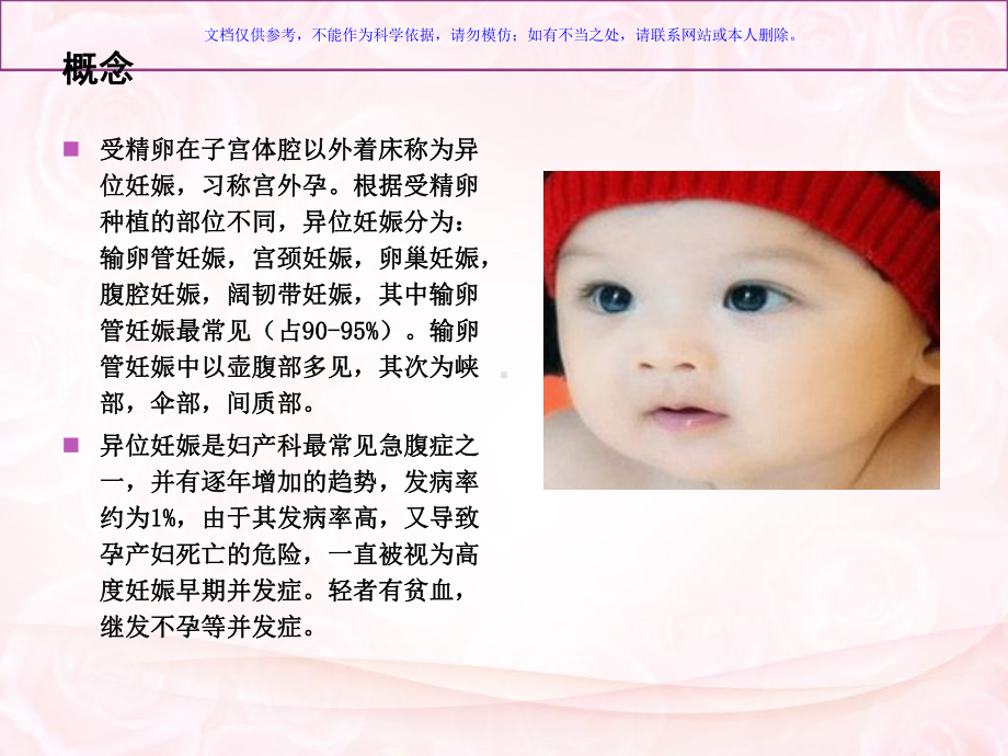 异位妊娠的中医辩证课件.ppt_第2页