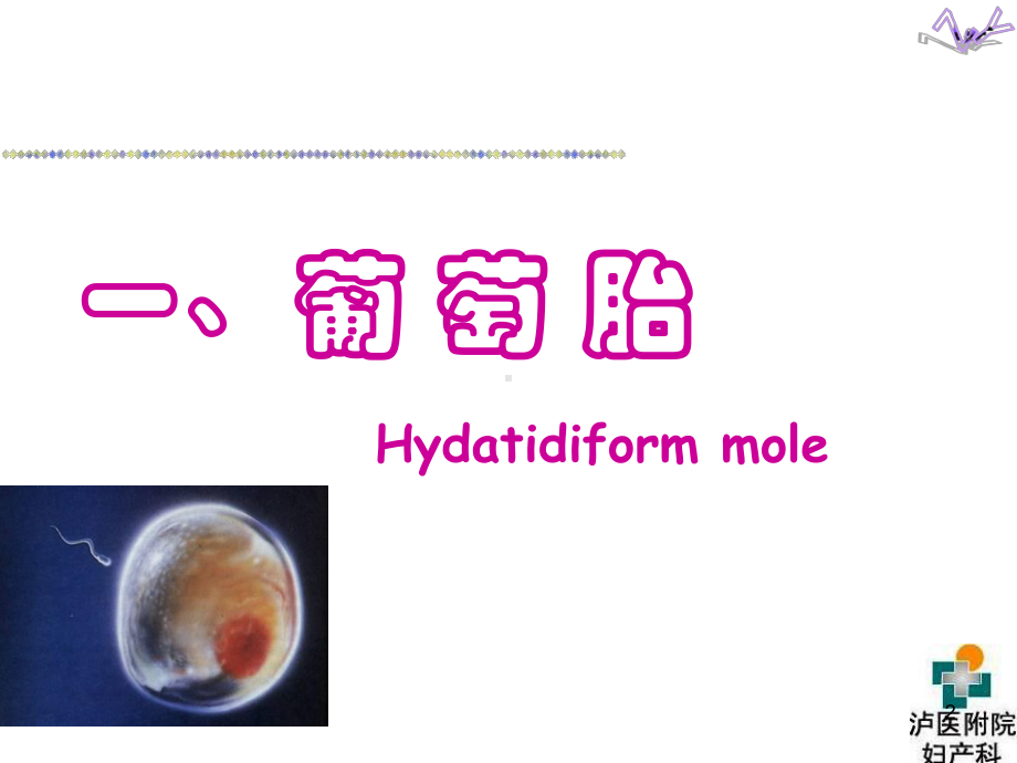 妇产科护理课件-妊娠滋养细胞疾病.ppt_第2页