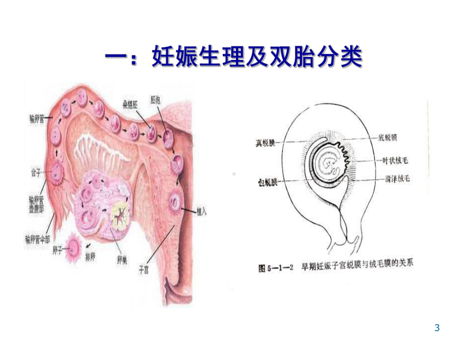 双胎妊娠ppt课件.ppt_第3页