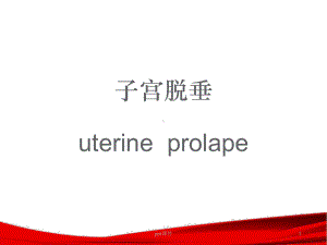 子宫脱垂-ppt课件.ppt