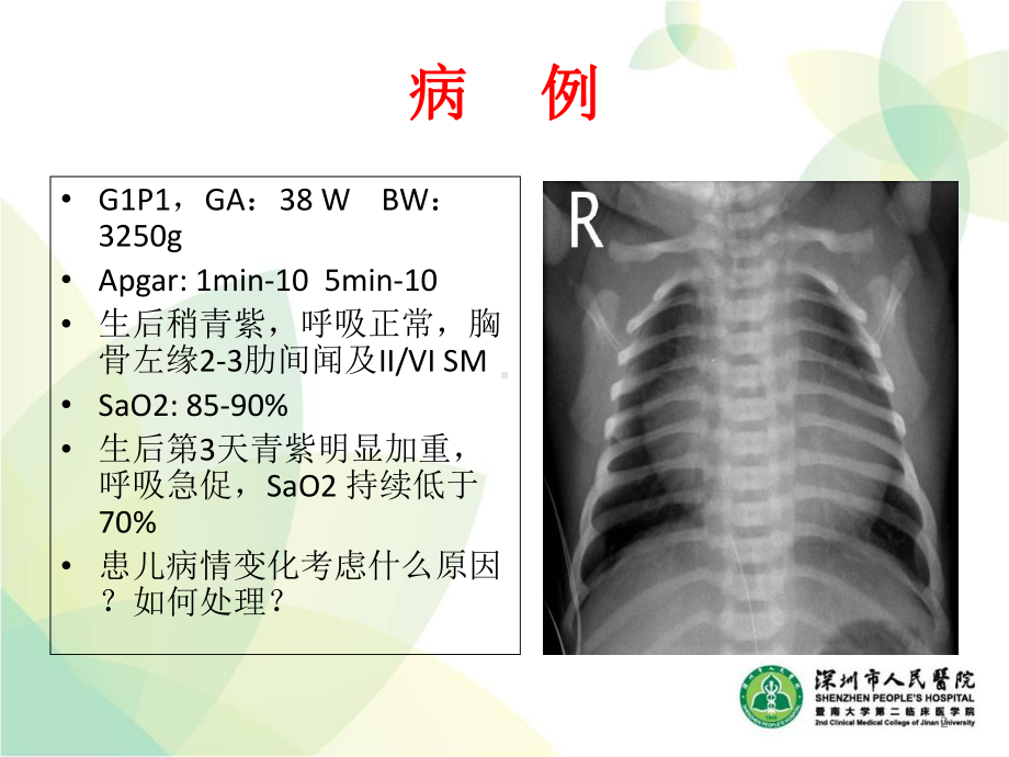 新生儿青紫的诊疗思路PPT课件.ppt_第2页