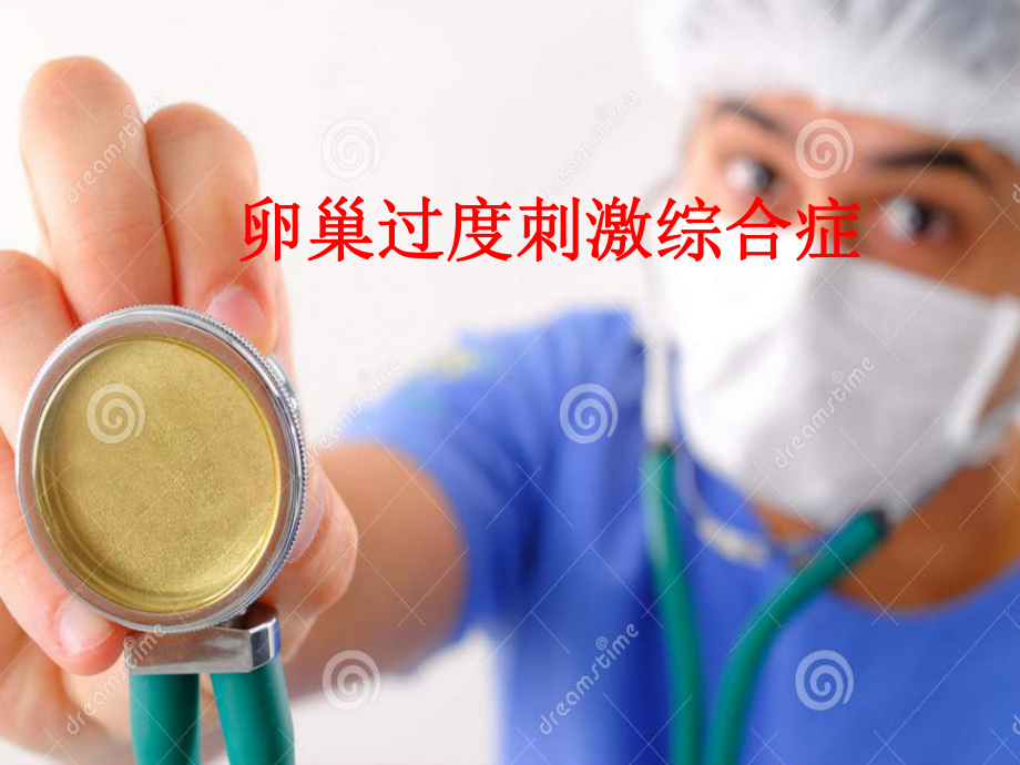 卵巢过度刺激综合征医学PPT课件.ppt_第1页