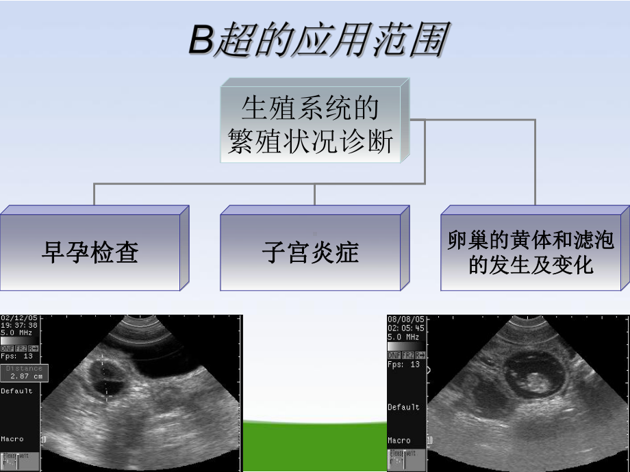 奶牛的妊娠诊断.ppt课件.ppt_第3页