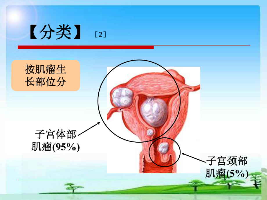 子宫肌瘤围手术期护理课件.ppt_第3页