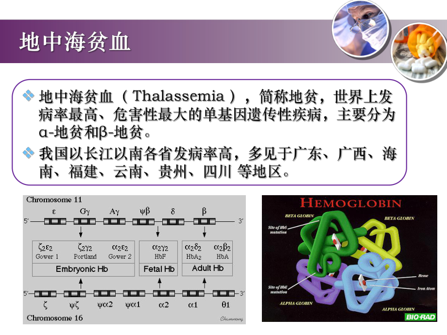 地中海贫血及新生儿筛查检测项目介绍-培训课件共28页.pptx_第2页