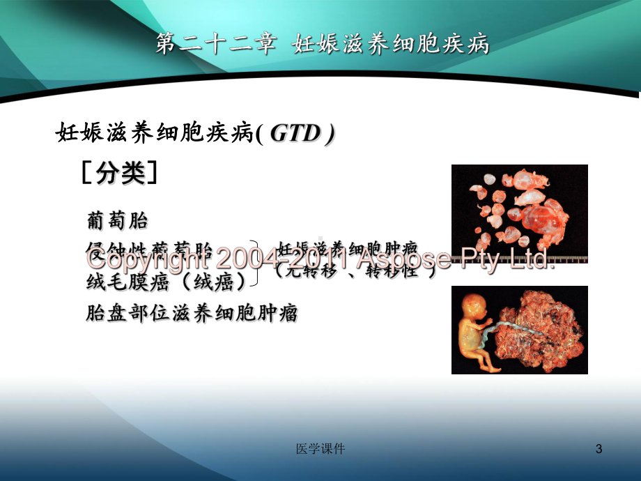 《妇产科学》第二版配套-妊娠滋养细胞疾病-P课件.ppt_第3页