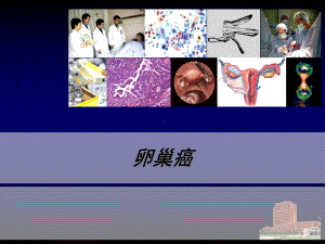 卵巢癌ppt课件.ppt