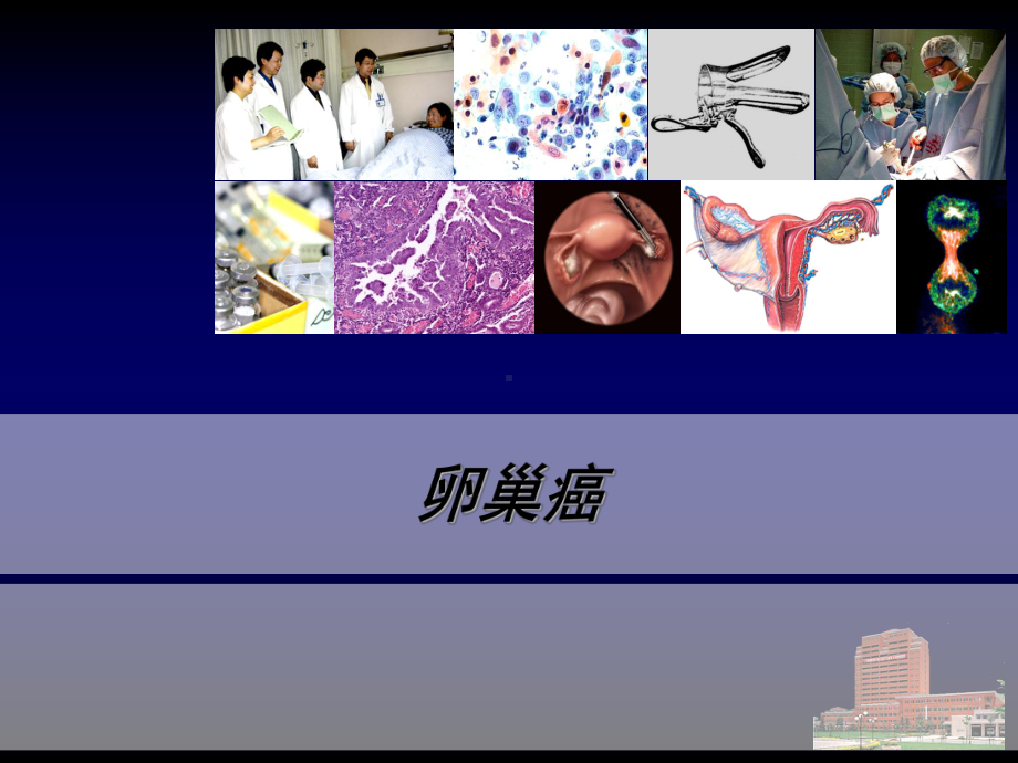 卵巢癌ppt课件.ppt_第1页