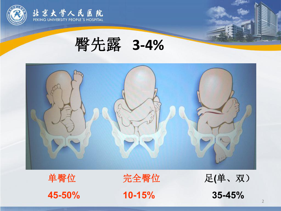 《臀位分娩》课件1.ppt_第2页