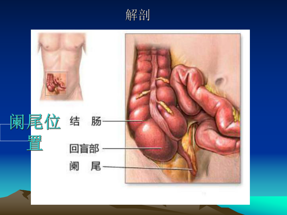 妊娠合并常见外科课件.pptx_第3页