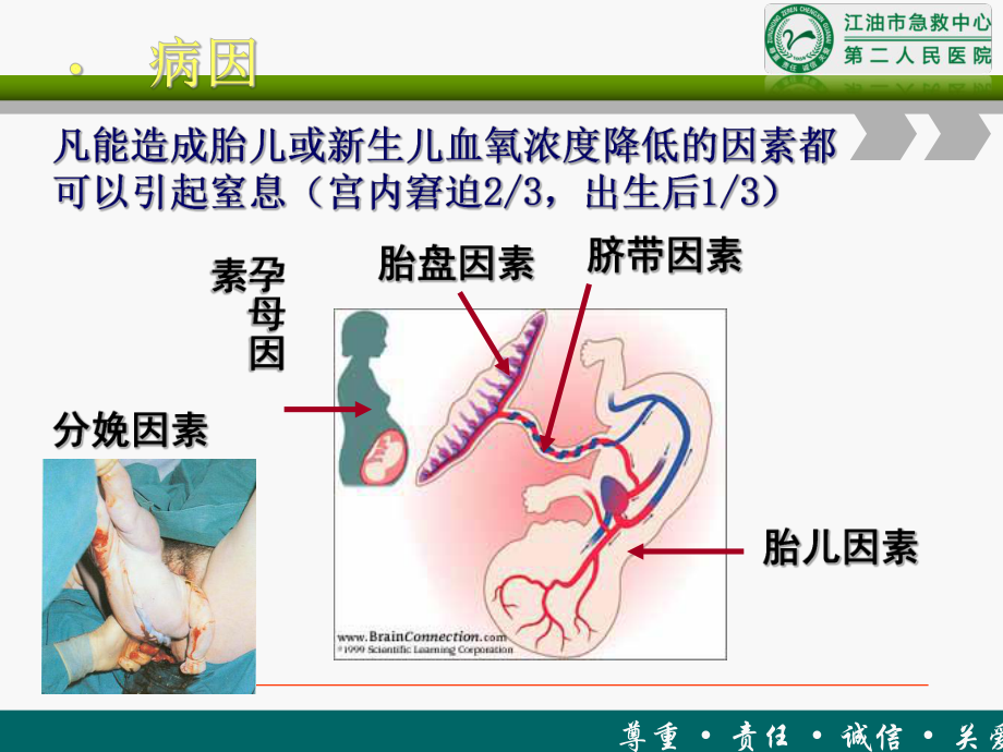 新生儿窒息第七版教材资料课件.ppt_第3页