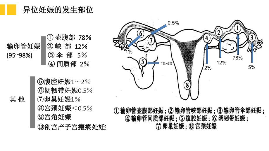 月宫外孕的护理查房课件.ppt_第3页