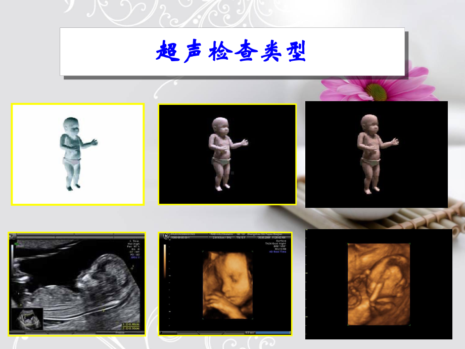 妇产科超声应用ppt课件.ppt_第2页