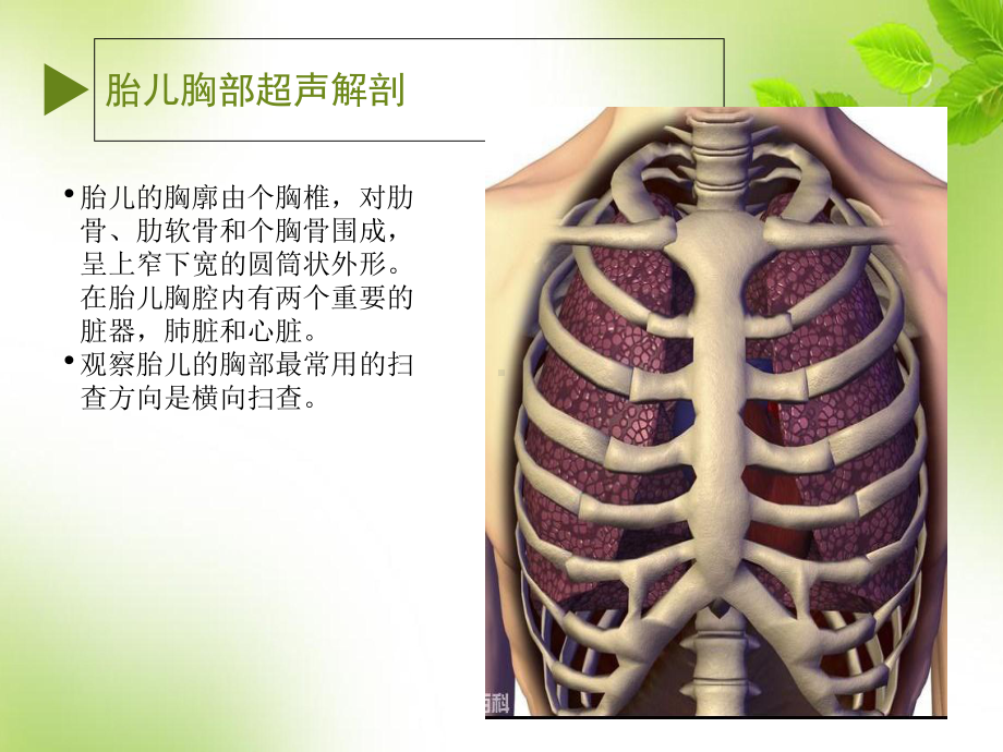 业务学习：胎儿胸部畸形课件.ppt_第2页