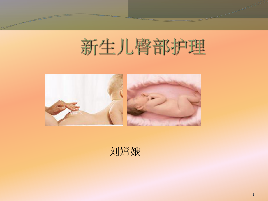 新生儿臀部护理刘嫦娥-ppt课件.ppt_第1页