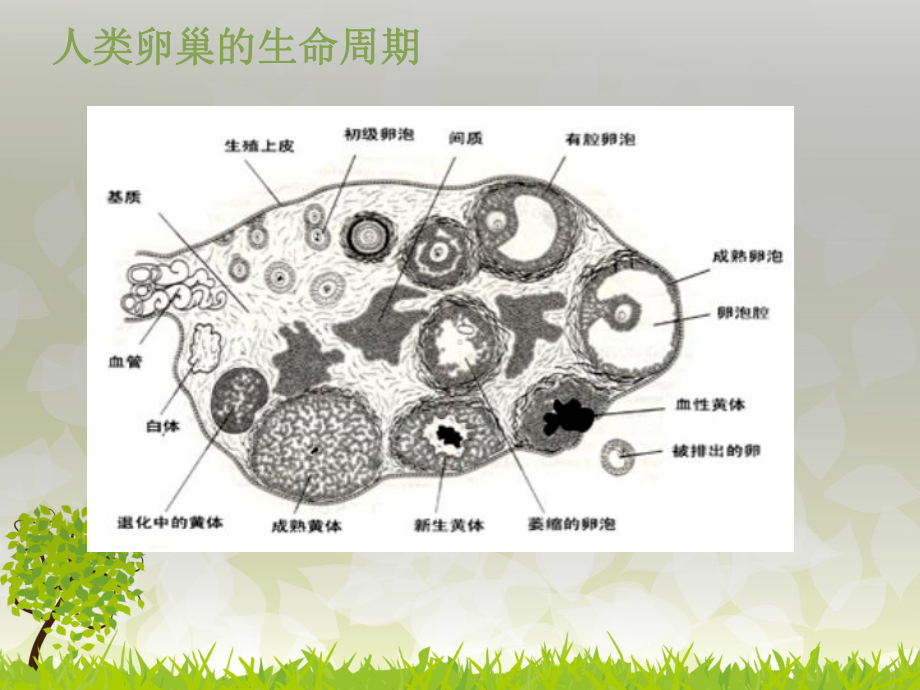 卵巢黄体破裂出血护理查房演示课件.ppt_第3页