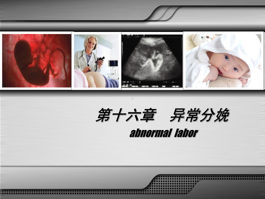 异常分娩-胎位异常课件.ppt_第1页