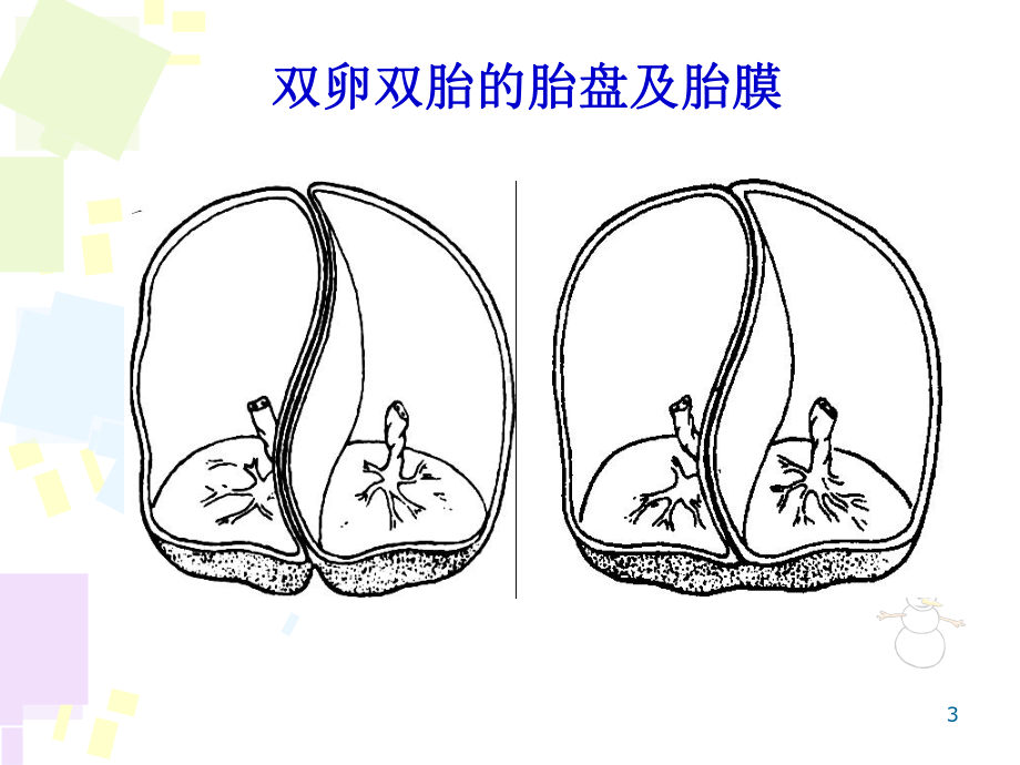 凶险型前置胎盘剖宫产麻醉与输血管理PPT课件.ppt_第3页