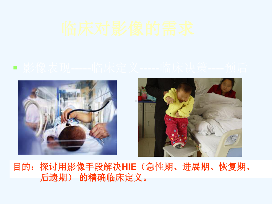 新生儿缺氧缺血性脑病影像学表现与临床定义课件.ppt_第2页