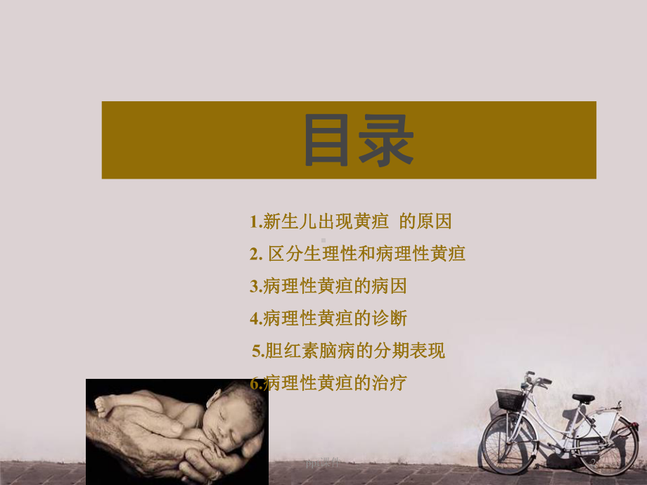 新生儿黄疸-ppt课件1.ppt_第2页