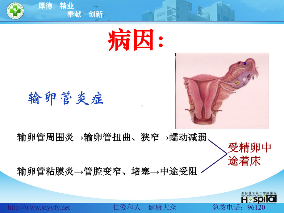 宫外孕的护理-ppt课件.ppt_第3页