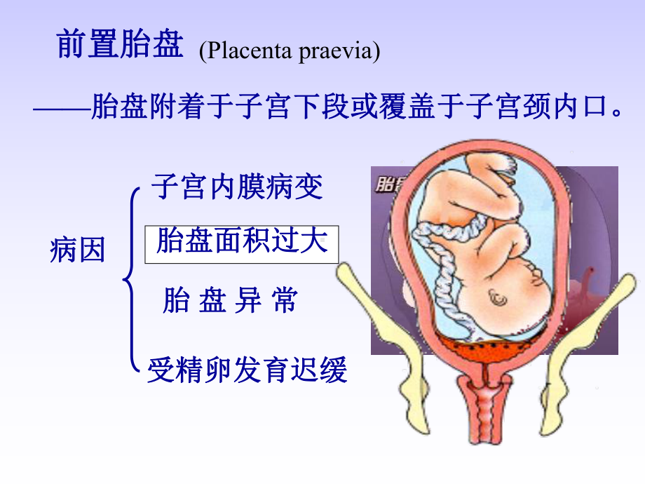 妊娠晚期出血性疾病课件.ppt_第2页