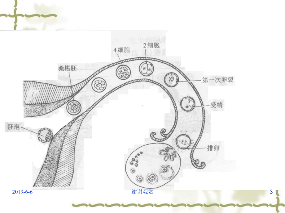 妊娠滋养细胞疾病人的护理解读课件.pptx_第3页