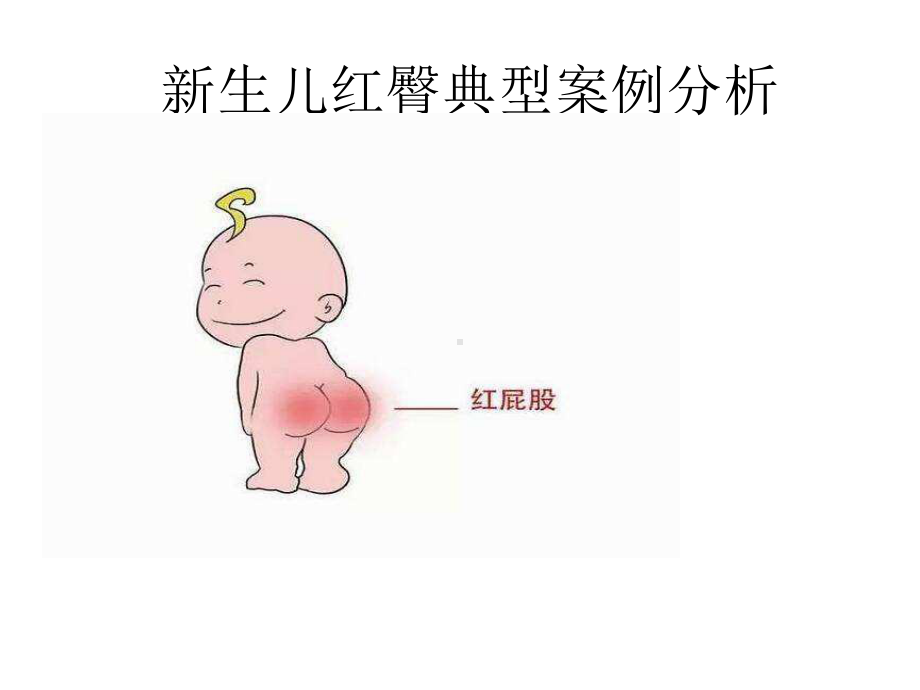 新生儿红臀案例分析课件.ppt_第1页