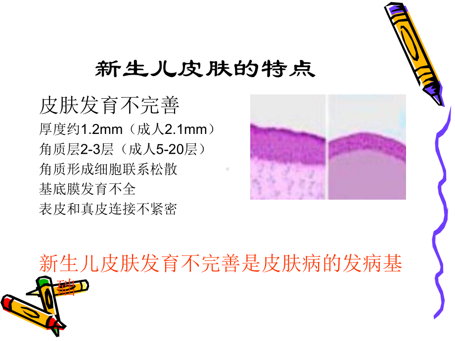 新生儿皮肤病课件.ppt_第2页