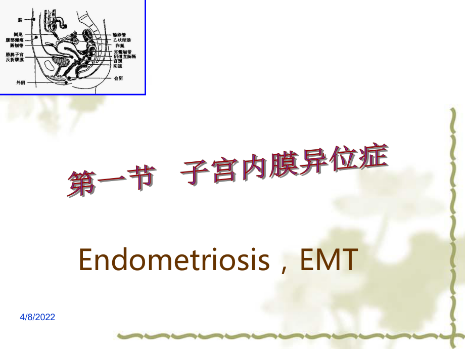 子宫内膜异位症和子宫腺肌症-PPT医学课件.ppt_第3页