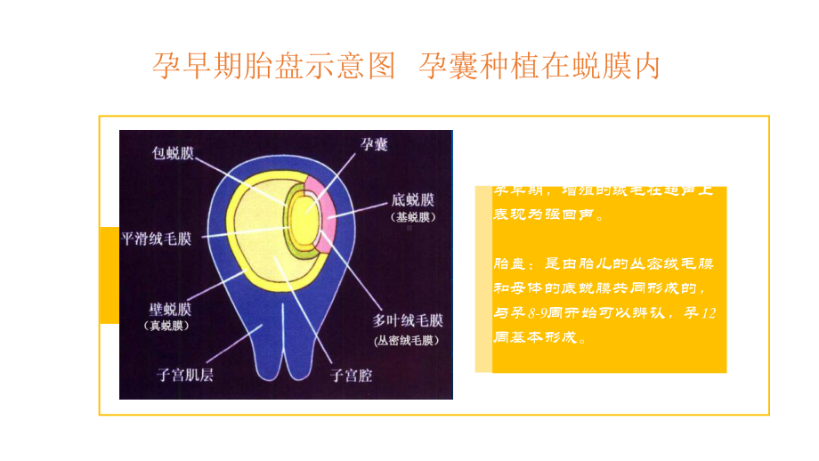 医学课件胎盘的超声检查.ppt_第3页