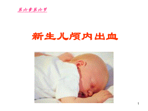 新生儿颅内出血-PPT课件.ppt