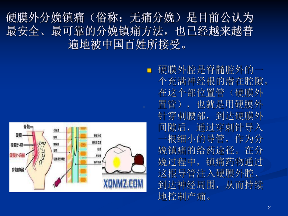 产后腰痛ppt课件.ppt_第2页