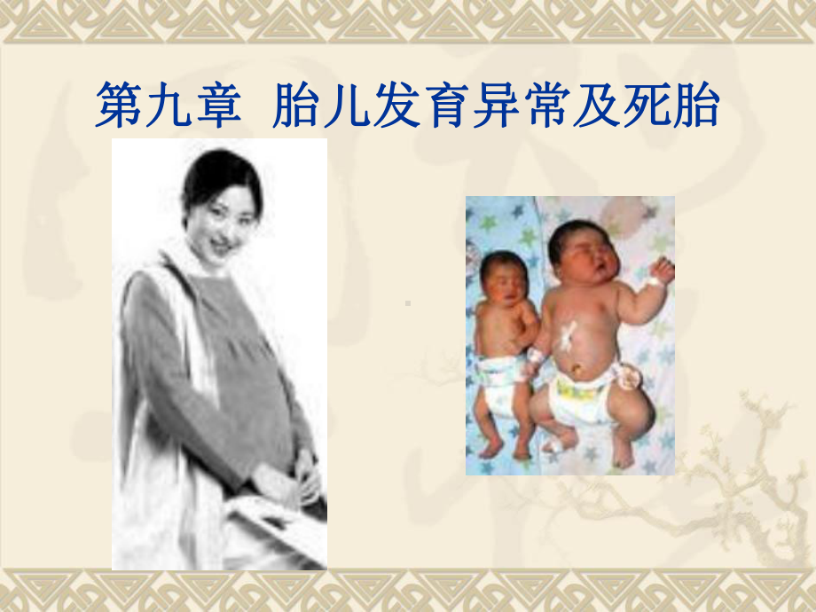 [精品]胎儿发育异常及死胎课件.ppt_第1页