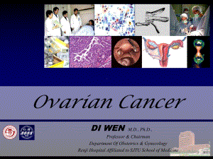 卵巢癌-Ovarian-Cancer- 课件.ppt