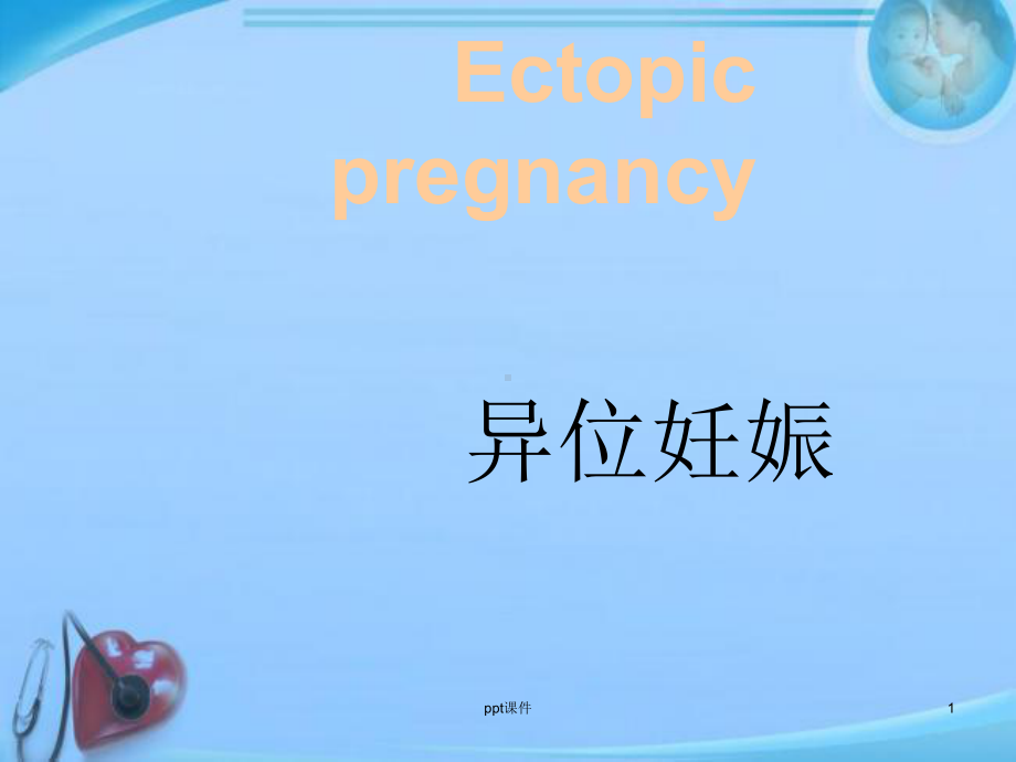 异位妊娠-(3)-ppt课件.ppt_第1页