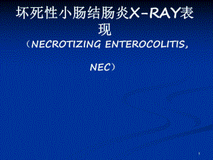 新生儿坏死性小肠结肠炎影像表现PPT演示课件.ppt