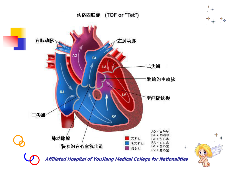 妊娠合并心脏病PPT课件-精品妇产科课件.ppt_第3页