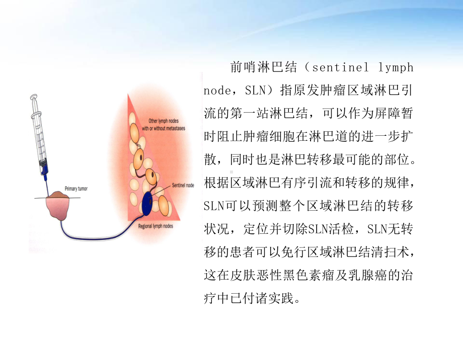 早期子宫颈癌前哨淋巴结检测的临床意义-ppt课课件.ppt_第3页